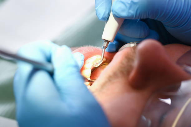 Best Emergency Treatment for Dental Infections or Abscesses in Keasbey, NJ