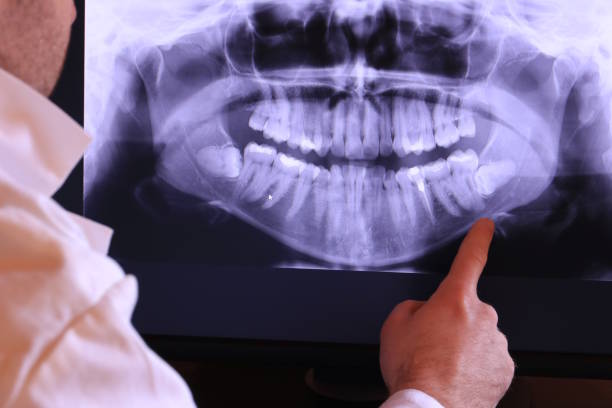 Best Weekend Emergency Dentist in Keasbey, NJ